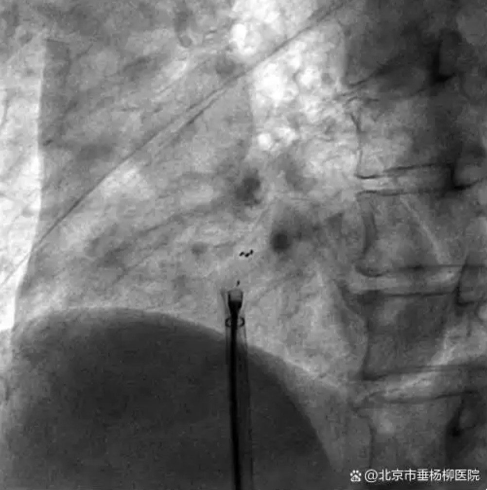 QQ20250620-093707.jpg